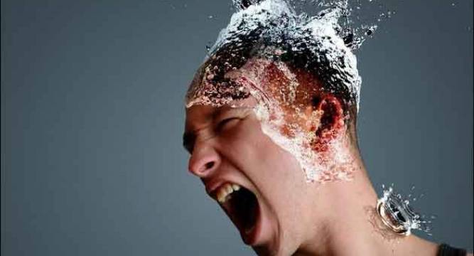 Suffering From Exploding Head Syndrome You Are Not Alone News Nation English