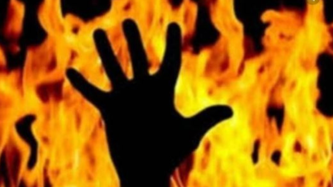 Raipur: Woman Battles For Life After Boyfriend's Family Set Her On Fire