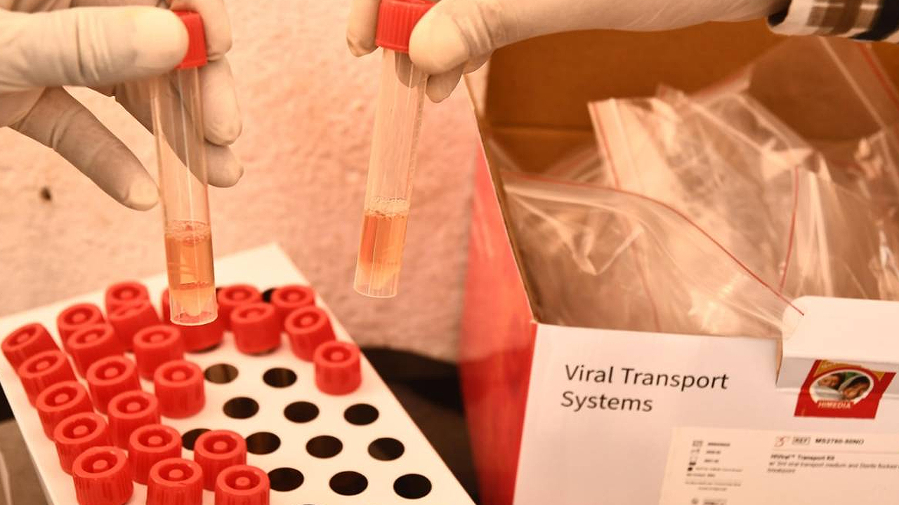 Coronavirus cases in UP cross 1,000-mark, death toll mounts to 17
